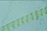 Spirogyra