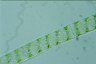 Spirogyra