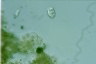 Vorticella