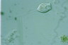 Vorticella