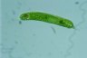 Euglena oxyuris