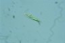 Euglena tripteris