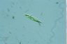 Euglena tripteris