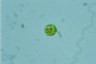 Haematococcus