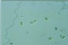 Oocystis