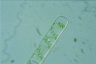 Spirogyra