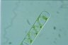 Spirogyra