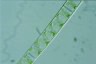 Spirogyra