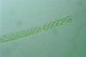 Spirogyra