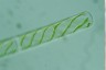 Spirogyra