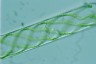 Spirogyra