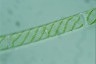 Spirogyra