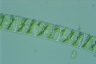 Spirogyra