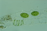 Spirogyra