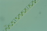 Spirogyra