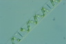 Spirogyra