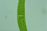 Closterium ehrenbergii