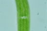 Closterium ehrenbergii