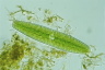 Netrium digitus