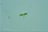 Cylindrocystis