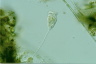 Vorticella