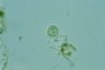 Choanocystis