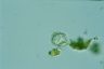 Choanocystis