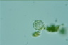 Choanocystis