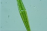 Closterium ralfsii