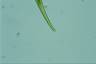 Closterium ralfsii