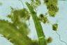 Closterium striolatum