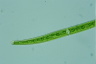 Closterium abruptum