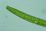 Closterium baillyanum