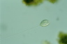 Vorticella