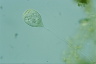 Vorticella