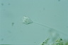 Vorticella