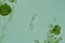 Vorticella convallaria