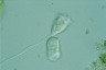 Vorticella convallaria