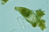 Cyphoderia ampulla