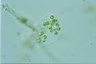 Apiocystis brauniana