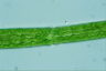 Pleurotaenium ehrenbergii