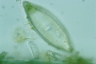 Neidium iridis