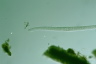 Spirostomum