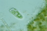 Condylostoma