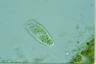 Paracondylostoma