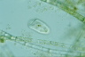 Condylostoma