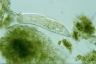 Paramecium