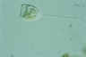 Vorticella