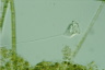 Vorticella