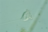 Vorticella